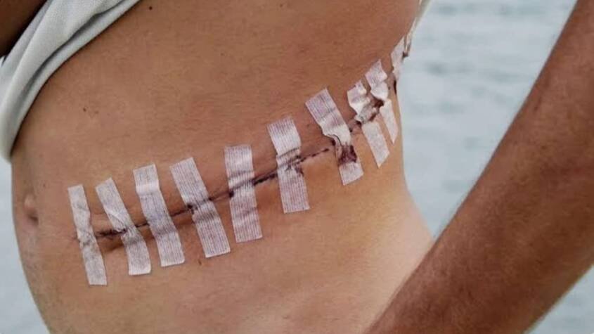 المليشيا تتاجر بأعضاء الأسرى والمعتقلين بدارفور